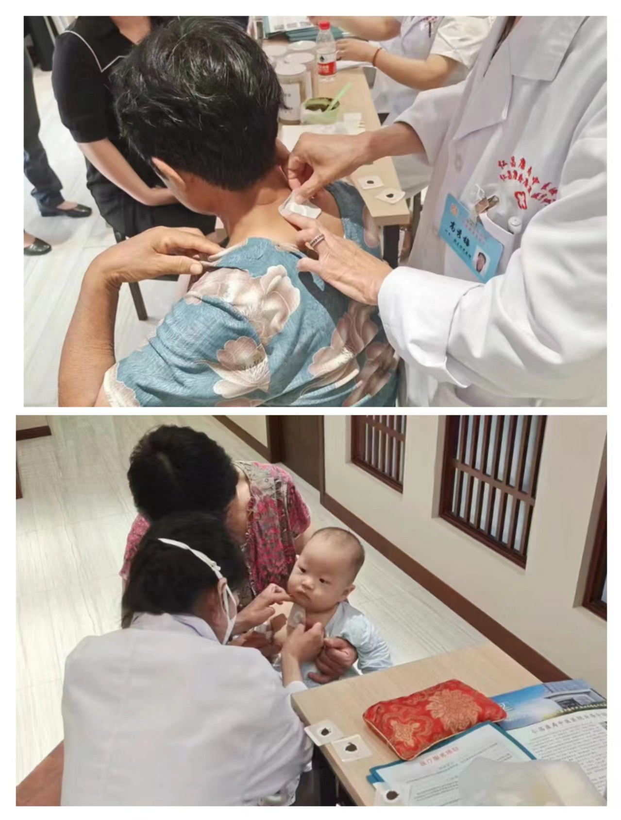 高秀梅主任为患者贴三伏贴